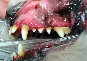 Stage 1 Periodontal Disease