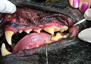 Stage 2 Periodontal Disease
